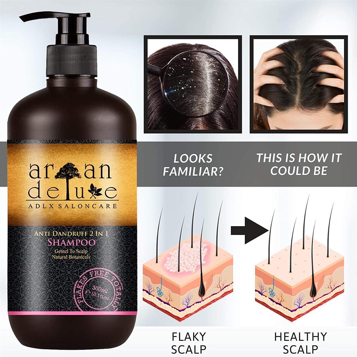 Argan Deluxe Anti-Schuppen Shampoo | Hilfe gegen Schuppen und juckende Kopfhaut